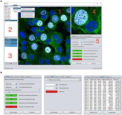 “Tonga”: A Novel Toolbox for Straightforward Bioimage Analysis